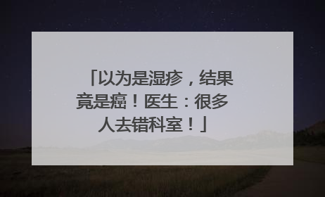 以为是湿疹，结果竟是癌！医生：很多人去错科室！